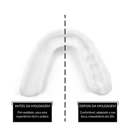 Imagem de Protetor Bucal noturno placa bruxismo SOVA 3D com estojo