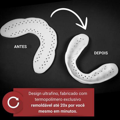 Imagem de Protetor Bucal noturno placa bruxismo SOVA Aero com estojo