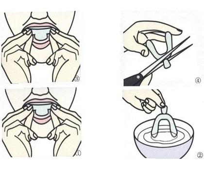 Imagem de Protetor bucal para bruxismo, anti-ronco, proteção noturna