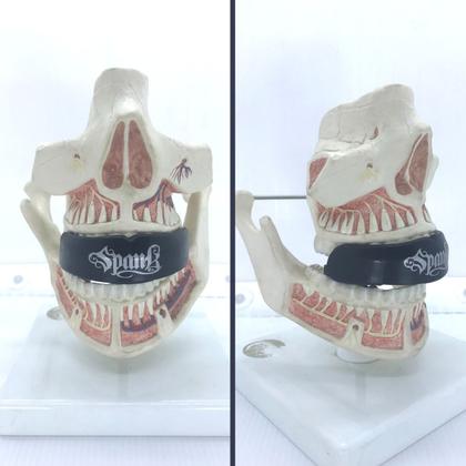 Imagem de Protetor Bucal Superior Profissional Spank - Preto