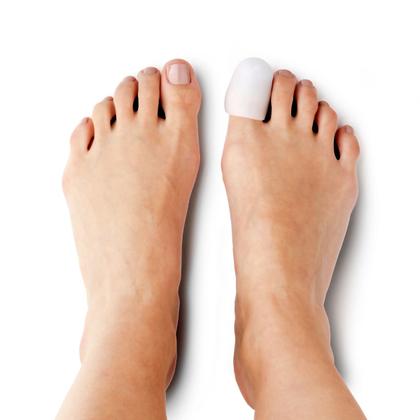 Imagem de Protetor para Unhas Encravadas - Hidrolight