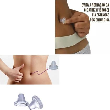 Imagem de Protetor Umbigo Protege Pós Cirurgia + Curativo Hypafix Fita Para Segurar Fixar Na Pele