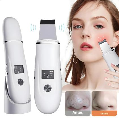 Imagem de Purificador Facial Ultrassônico, Limpeza Profunda Dos Poros, Peeling Da Pele, Remoção De Acne,