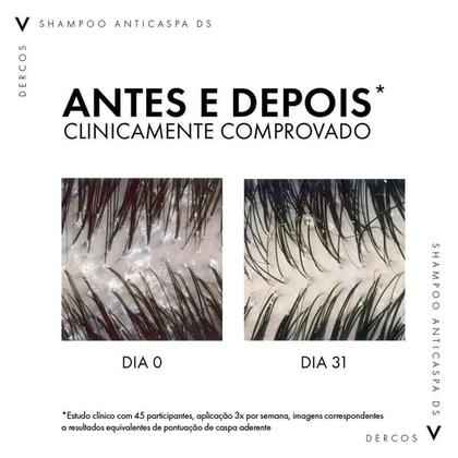 Imagem de Refil Shampoo Anticaspa DS Vichy Dercos Cabelos Normais e Oleosos 200g