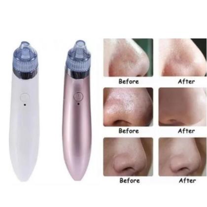 Imagem de Removedor De Cravo Elétrico Extrator Espinhas Vácuo Usb