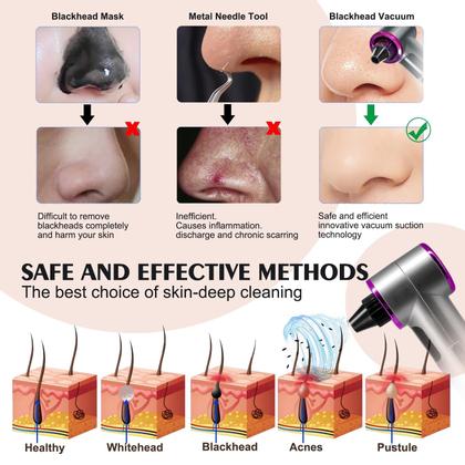 Imagem de Removedor de cravos a vácuo Tlettsteinkle com 9 modos de aquecimento