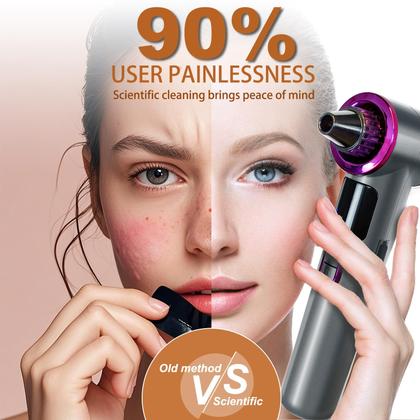 Imagem de Removedor de cravos a vácuo Tlettsteinkle com 9 modos de aquecimento