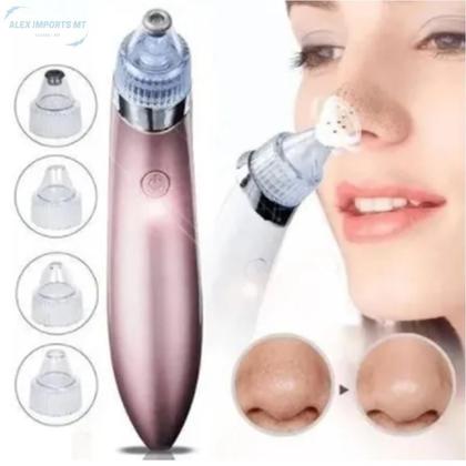 Imagem de Removedor De Cravos Aparelho Sucção Vácuo Remove Espinhas