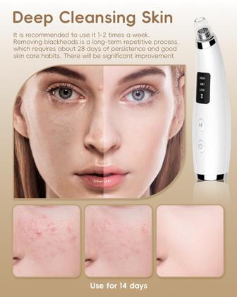 Imagem de Removedor de cravos faciais a vácuo FLYMOOO com 5 sondas