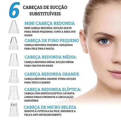 Imagem de Removedor de Cravos Recarregável com Sucção a Vácuo