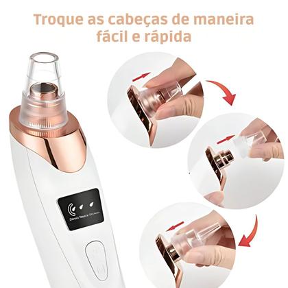 Imagem de Removedor Elétrico De Cravos A Vácuo Extrator De Espinhas