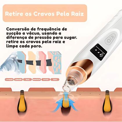 Imagem de Removedor Elétrico De Cravos A Vácuo Extrator De Espinhas