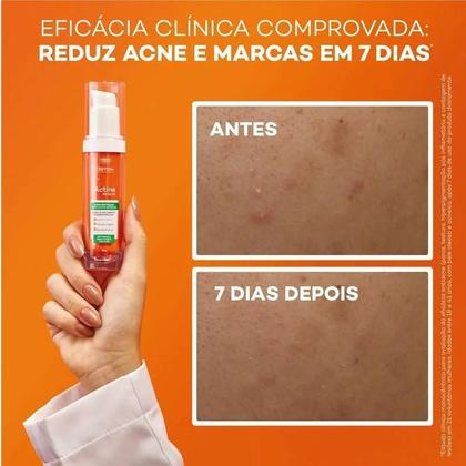 Imagem de Renovador Antiacne Darrow Actine Renov Concentrado 30g