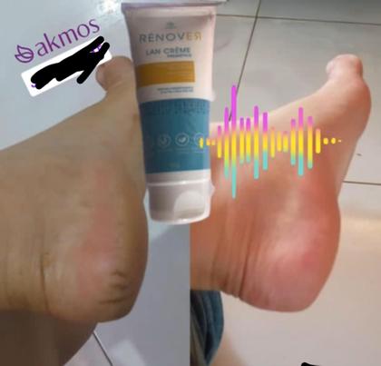 Imagem de Rénover Lan Creme Prebiótico