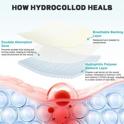 Imagem de Rolo de hidrocolóide para tratamento de feridas Ruzmmo Medical Grade 5m