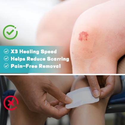 Imagem de Rolo de hidrocolóide para tratamento de feridas Ruzmmo Medical Grade 5m