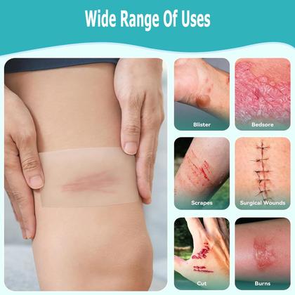 Imagem de Rolo de hidrocolóide para tratamento de feridas Suphan 5cm x 5m