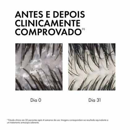 Imagem de Sérum 10 Vichy Dercos Anticaspa