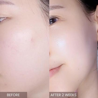 Imagem de Sérum APLIN Pink Tea Tree Synergy 30 mL com CICA, ácido hialurônico