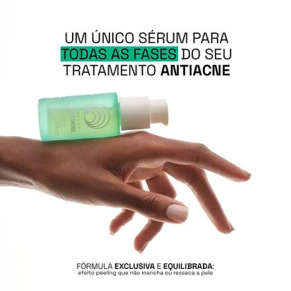 Imagem de Sérum Beyoung Acne Control 30ml