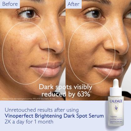 Imagem de Sérum Caudalie Vinoperfect para clarear manchas escuras 30mL