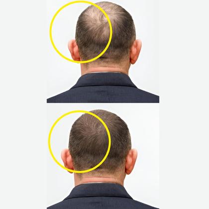 Imagem de Sérum de crescimento capilar Masofta 50 ml Redensyl Capixyl Biotina