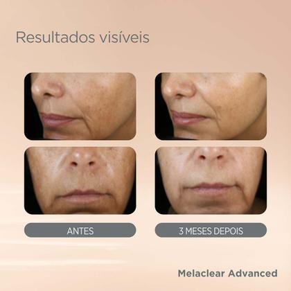 Imagem de Sérum Facial Clareador Isdin - Melaclear Advanced