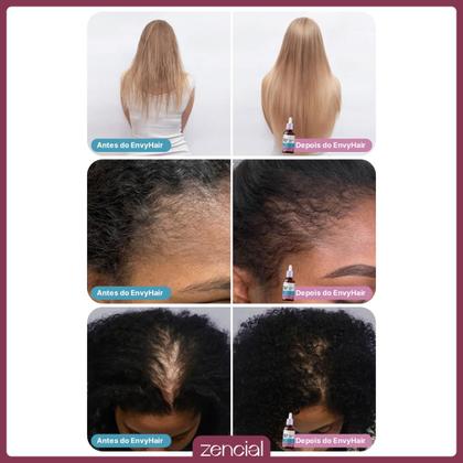 Imagem de Sérum Fortalecedor para Crescimento Capilar e Fios Sem Frizz