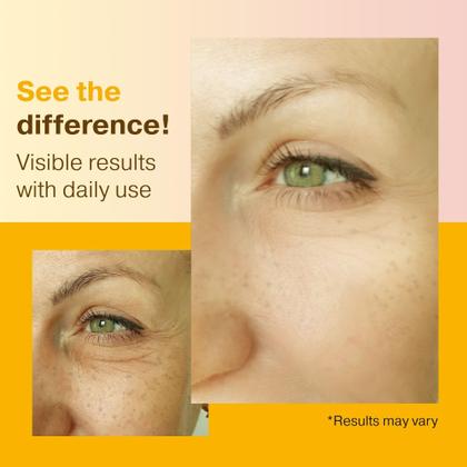 Imagem de Sérum Go Radiance Super Vitamin C 5% com niacinamida 60mL