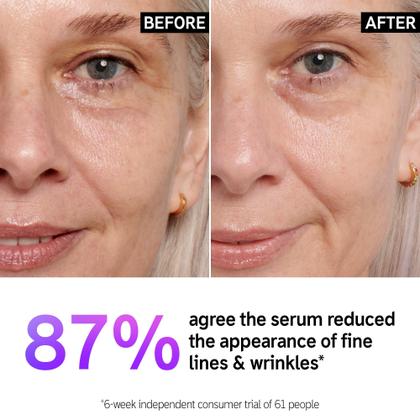 Imagem de Sérum The INKEY List Retinol 1% de Liberação Lenta - 30ml - Para Todos os Tipos de Pele
