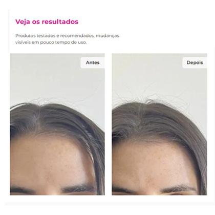 Imagem de Shampoo a Seco Berries Shakeberry Antioleosidade Ricca 150ml