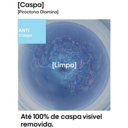 Imagem de Shampoo loreal scalp advanced anti-pelliculaire dandruff anti caspa 300ml