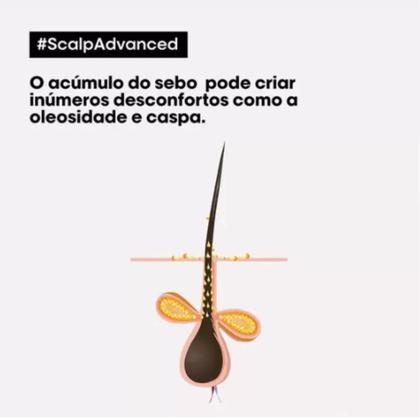 Imagem de Shampoo loreal scalp advanced anti-pelliculaire dandruff anti caspa 300ml