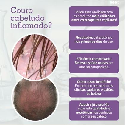 Imagem de Shampoo para Cabelos Oleosos Refresh 300ml