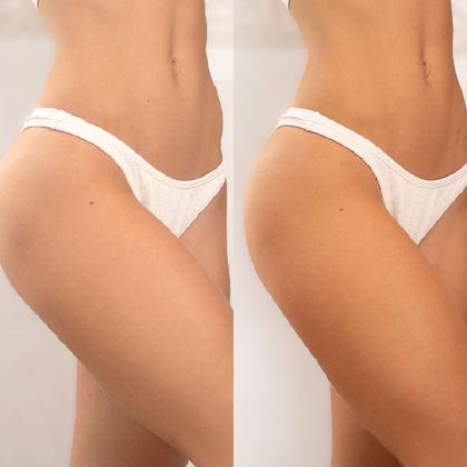 Imagem de Skelt Mousse Autobronzeador 140ml e Luva Aplicadora -  KIT