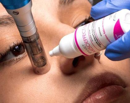 Imagem de Smart Mesoeffect Like - Complexo Rejuvenescedor - Smart GR