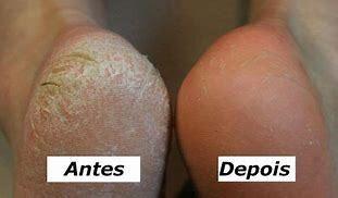 Imagem de Solução Dupé - Natulife 30ml