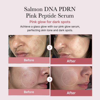 Imagem de Soro Facial Medicube Salmon DNA PDRN - Com Peptídeos e Rosa - 30ml