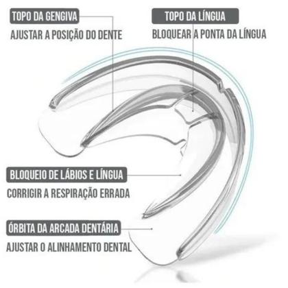 Imagem de Suporte Moldeira Dental Anti Bruxismo Protetor Bucal de Silicone