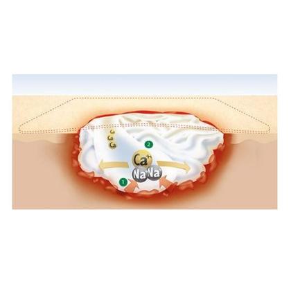 Imagem de Suprasorb A Curativo de Alginato de Calcio Esteril 10X10 CM 10 Unidades