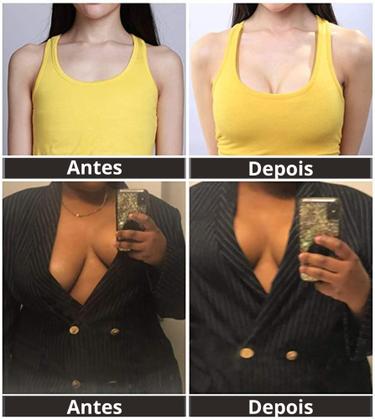 Imagem de Sutiã Adesivo Levanta Peito Seio Fita Boob Up Invisível Pele