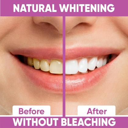 Imagem de Tiras de clareamento dentário Glowee Gentle Bleaching (28 listras)