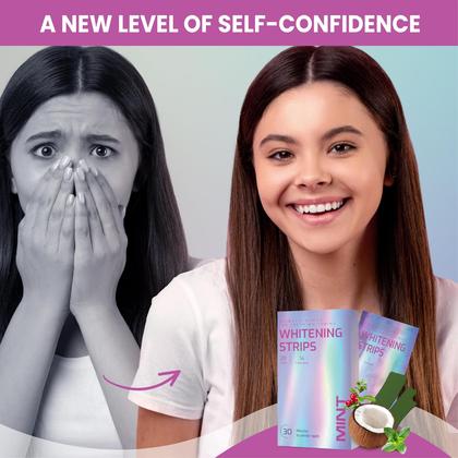 Imagem de Tiras de clareamento dentário Glowee Gentle Bleaching (28 listras)