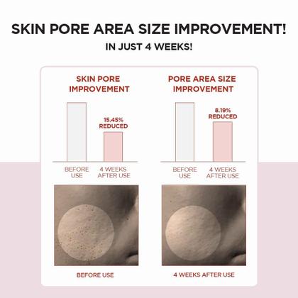 Imagem de Tônico Facial SKIN1004 Madagascar Centella - 210ml - Limpeza Purificante