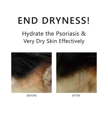 Imagem de Tônico para a Pele Aromase 80 ml Spray de Ácido Glicirrético