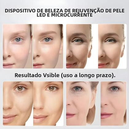 Imagem de Varinha De Beleza Facial Com Luz LED De 5 Cores Para Terapia, Massageador De Cuidados Com a Pele Com