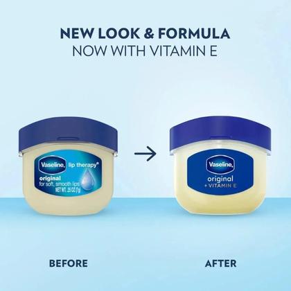 Imagem de Vaseline Lip Therapy Original