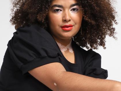 Imagem de Vestido Curto Vista Magalu Moletom Manga Bufante