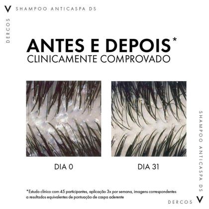Imagem de Vichy Dercos Shampoo Anticaspa DS - Cabelos Normais a Oleosos