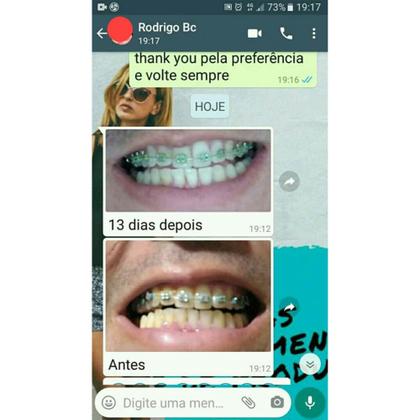 Imagem de White Carvo Mint